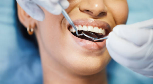 Best Emergency Denture Repair in Belleville, MI