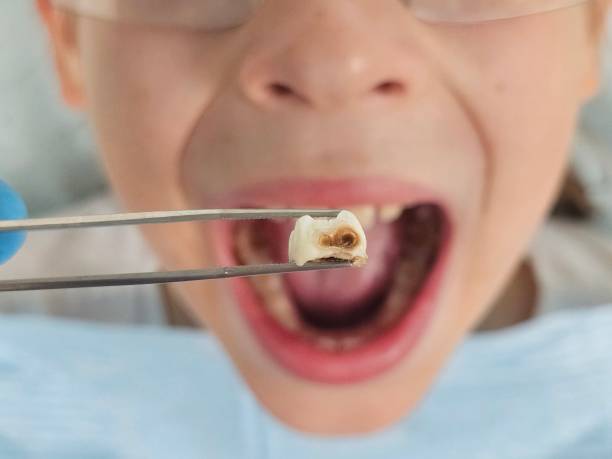 Best Emergency Treatment for Oral Infections in Belleville, MI